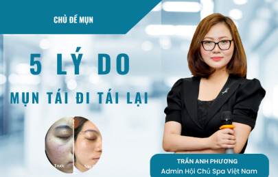 5 Lý Do Khiến Mụn Tái Đi Tái Lại